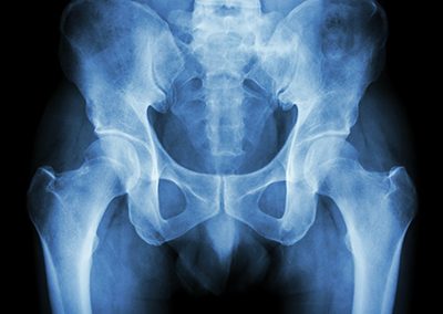 pelvic-fellowship Pelvic Fellowship